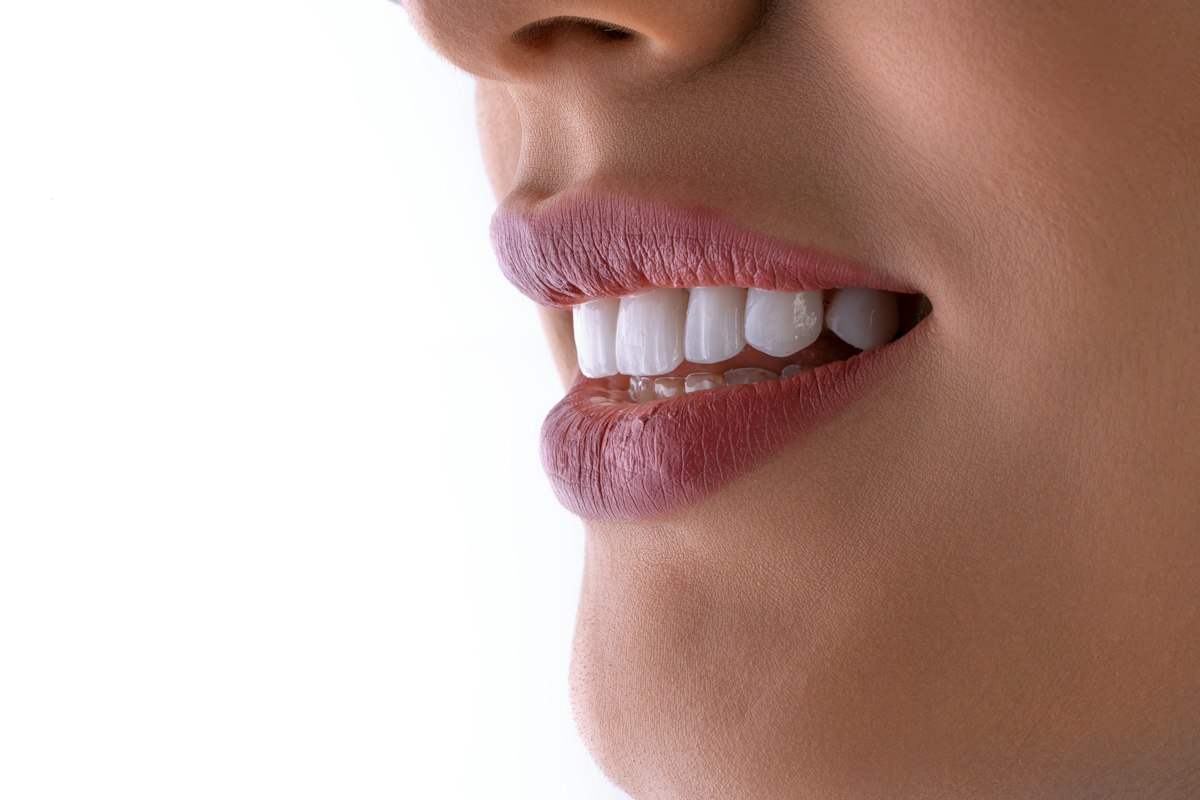 Dentística